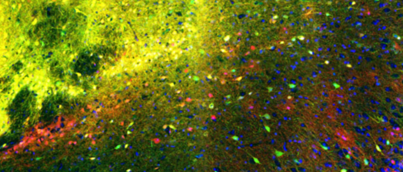neuron