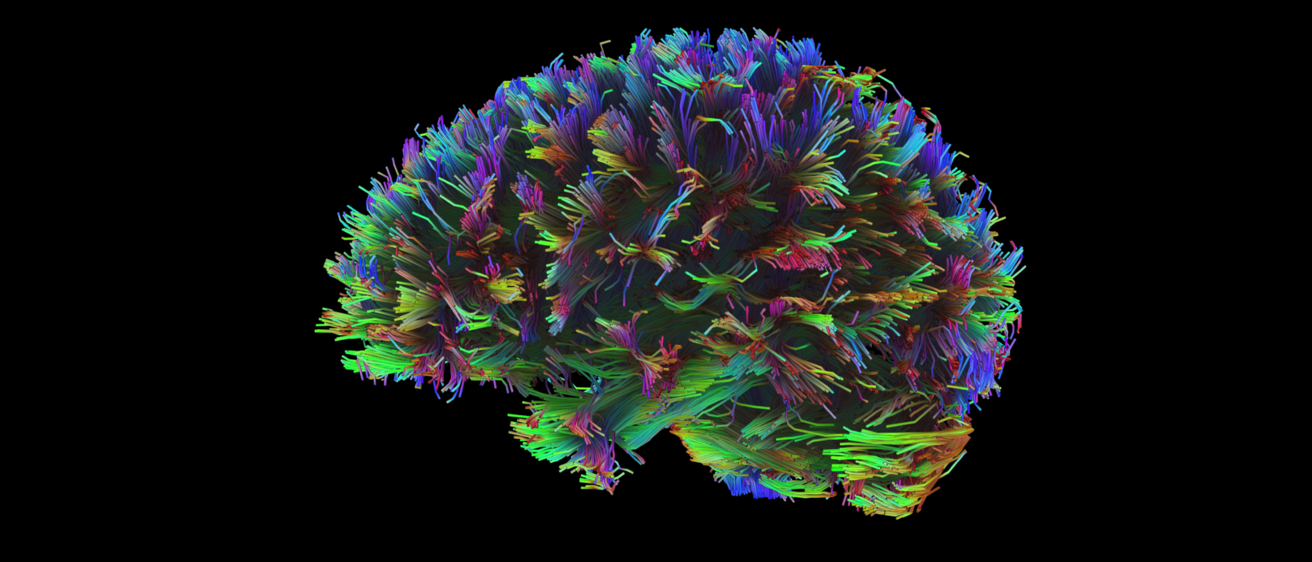 brain neurons lit up