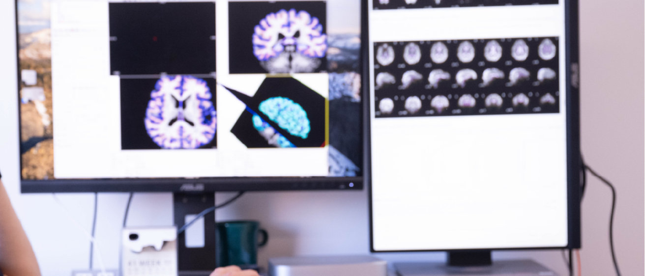 brain research