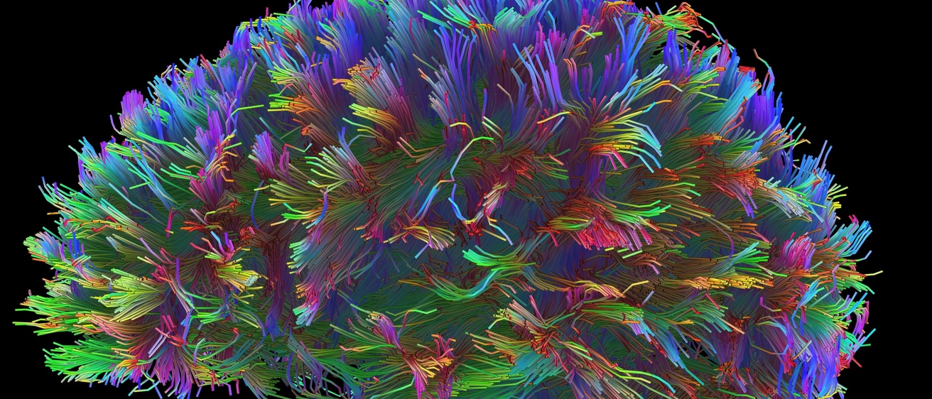 brain neurons lit up