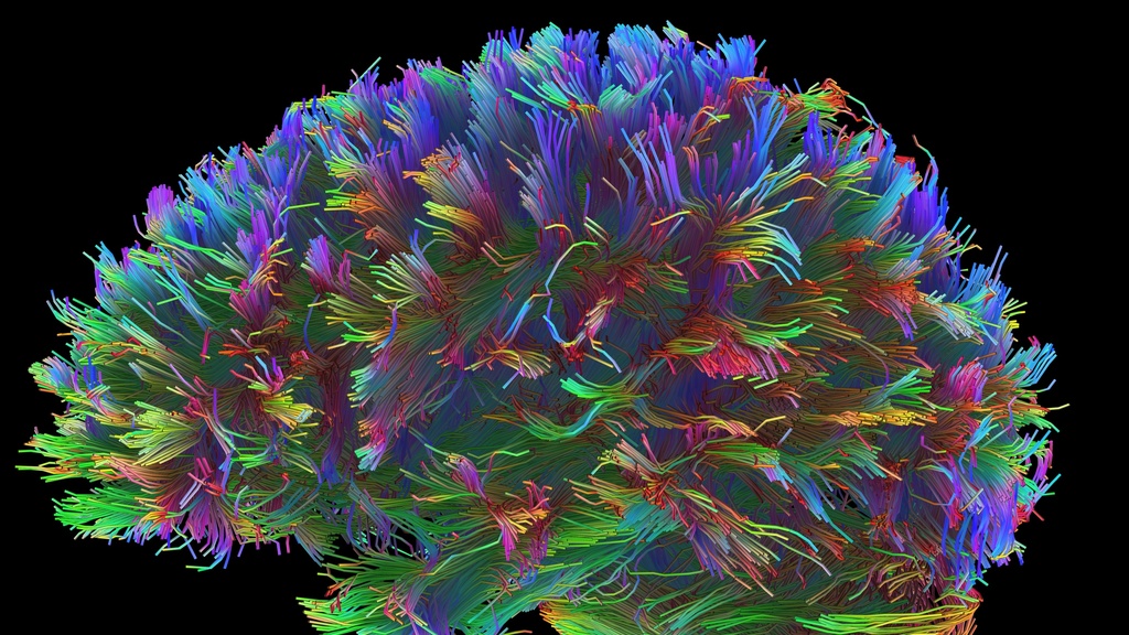 brain neurons lit up